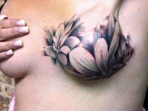 Tatuaje y cancer de mama
